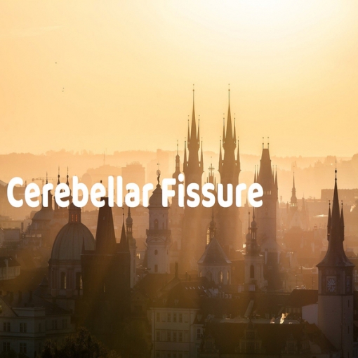 Cerebellar Fissure